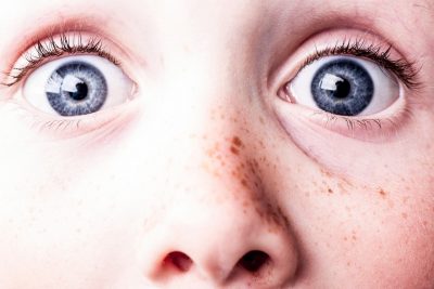 surprised-kid-freckles